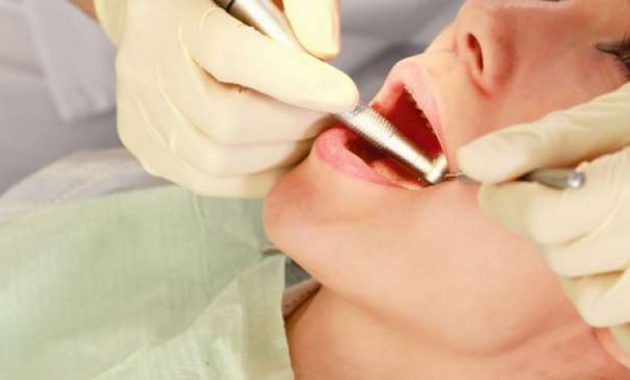 Top 10+ Daftar Pilihan Praktek Dokter Gigi Yang Murah dan Bagus di Daerah Bali