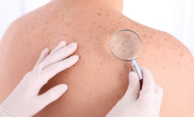 Top 10+ Rekomendasi Dokter Kulit Yang Kompeten dan Siap Melayani Kamu di Pekalongan dan Sekitarnya